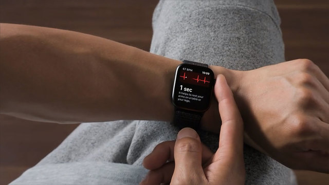 Apple Watchで心電図の記録