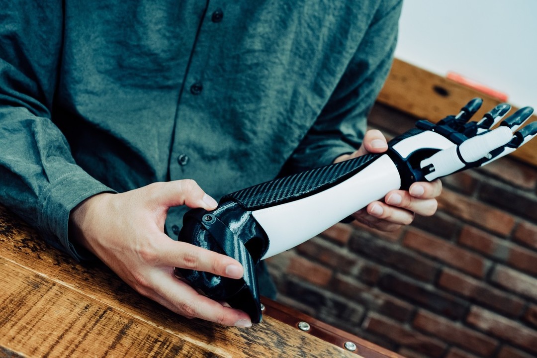 義手を持つ小笠原さん