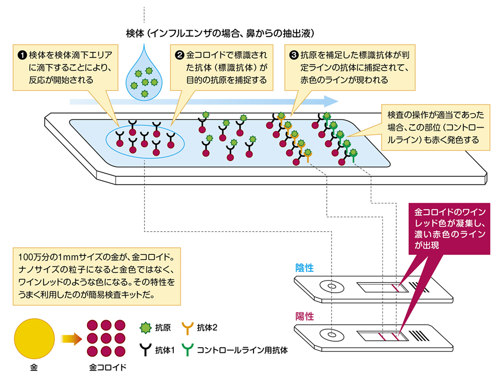 検査の流れのイラスト
