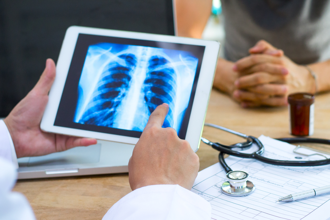 レントゲン写真