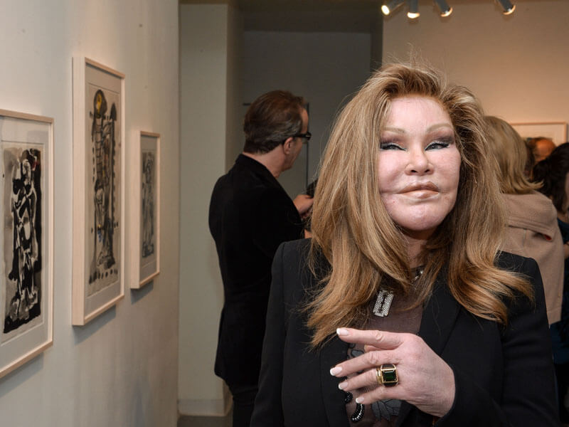 離婚の慰謝料3000億円 整形を繰り返す女性ソーシャライトの激しい人生 Mashing Up