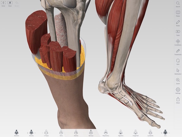 150910ipadProAnatomy2.jpg