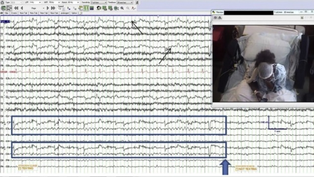 160630neurologicaltxt2.jpg