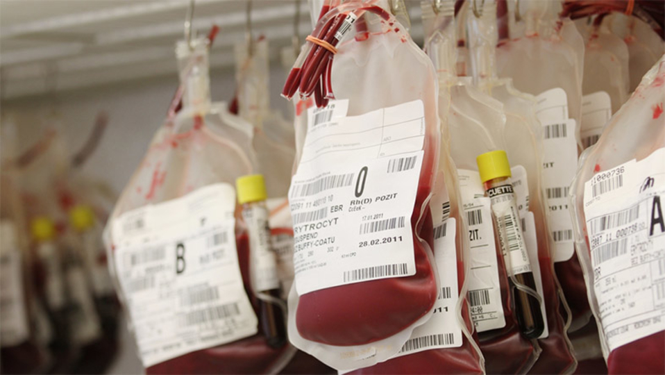 スタートアップ「Ambrosia」若い人間の血しょう注入の臨床試験を開始。600人のモニター募集中