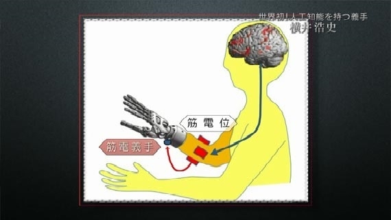 「人工知能を備えた義手」でめざすバリアフリー。脳と機械の融合はもう始まっています02