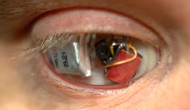 1 かつて目があったところにはカメラがある。「アイボーグ」になったカナダの映画作家の夢は「電脳化」