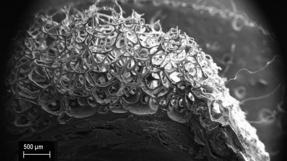 ヒルの卵嚢、拡大して見てみたら美しかった