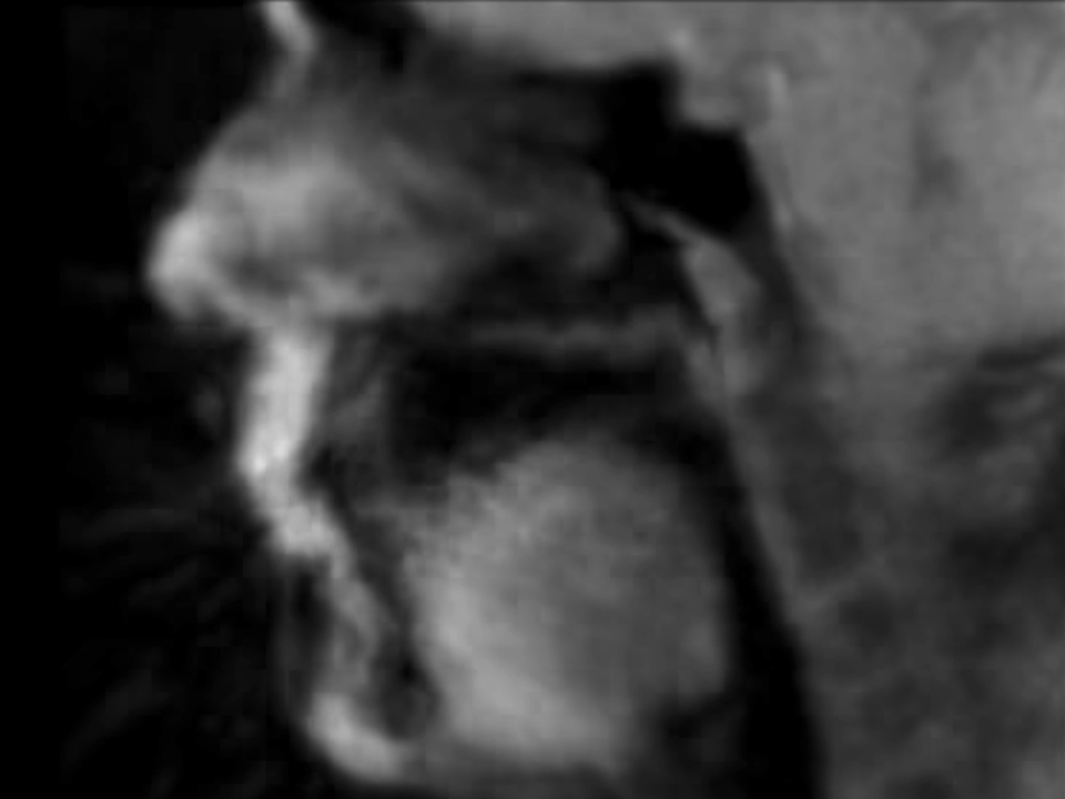 ベロ筋、暴れまくり！ ヒューマン・ビートボックスをMRIスキャンしてみた