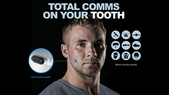 歯に装着する謎の通話デバイス、ペンタゴンから多額の資金を調達