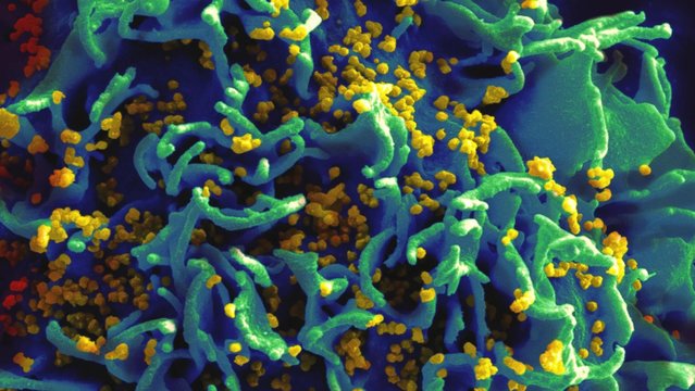 CRISPR-Cas9でマウスからHIVウイルスを除去することに成功。AIDSの画期的治療法の確立に期待