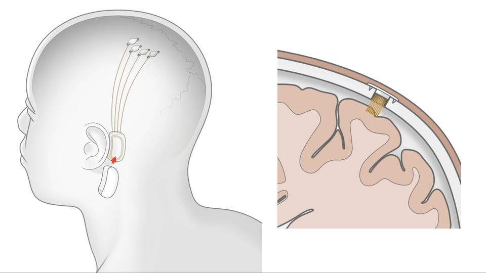 20190717-neuralink-hello-world-05