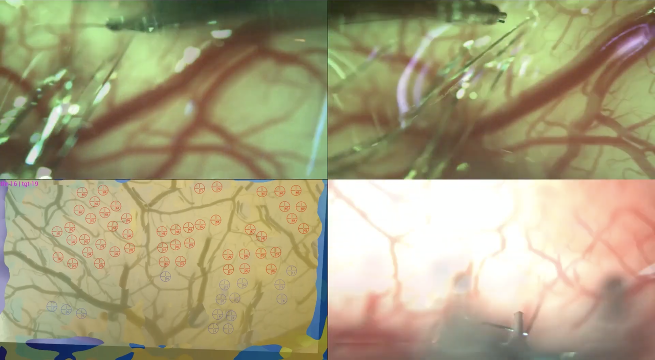 20190717-neuralink-hello-world-08