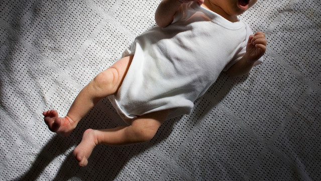 フサフサの赤ちゃんが17人報告される→薬が入れ替わっていた