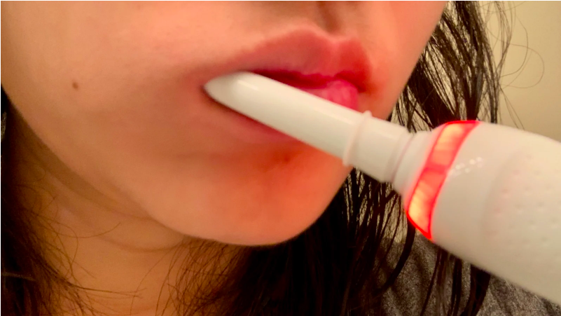 191105OralBGeniusX4