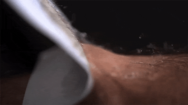 早漏改善パッチ、剥がすとき痛くないって