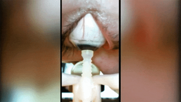 ロボットへの信頼感が試されてる? コンタクトレンズ装着してくれるロボット