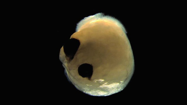 人間の脳のオルガノイドを培養したら「目」ができた