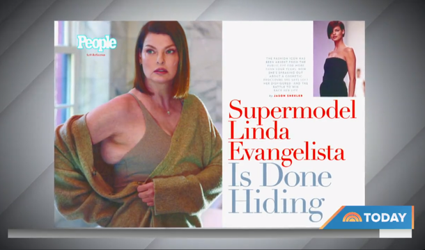 脂肪冷却で一生とれない脂肪がついた！ スーパーモデルが写真公開、巨額賠償訴訟