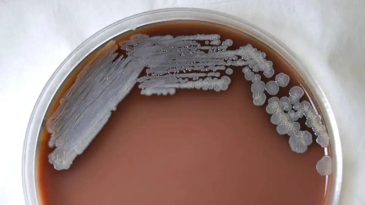 220528_emergingdiseases2