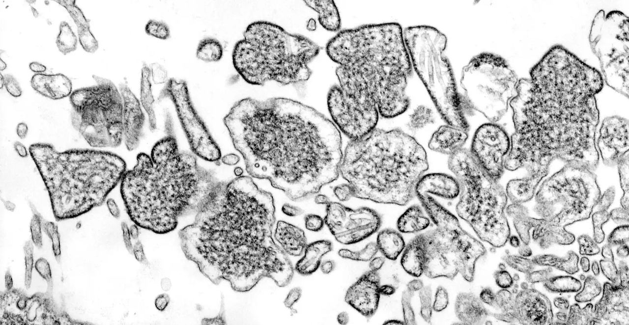 220528_emergingdiseases6