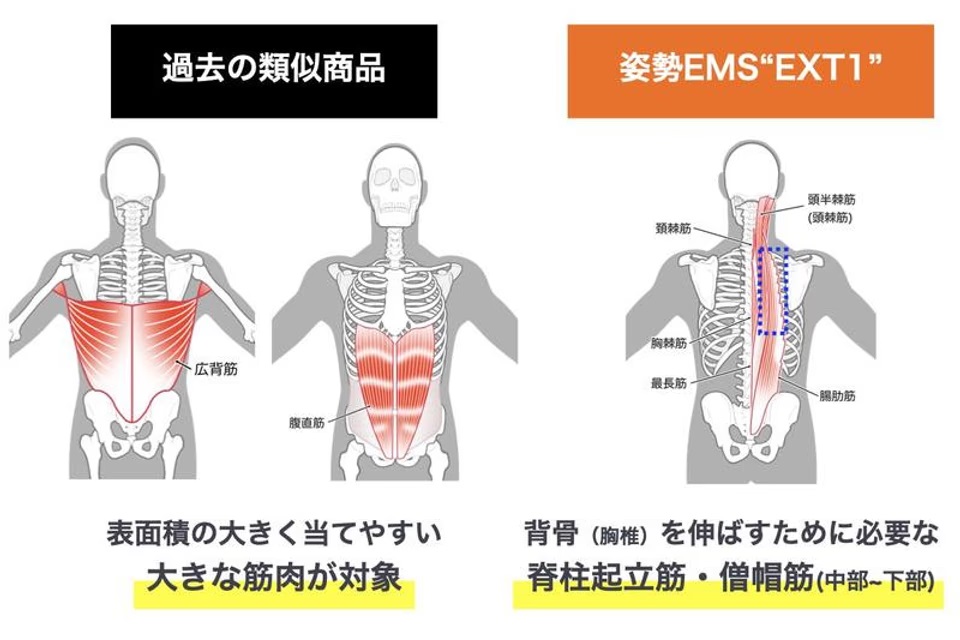 ムリなく姿勢筋トレーニング。新世代EMSなら1日10分で理想の姿勢に 