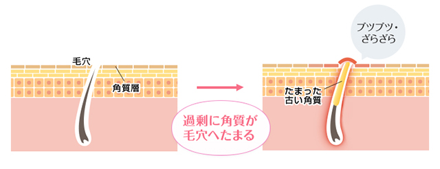 20180410_ninocure10