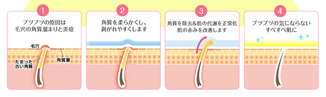 20180410_ninocure11
