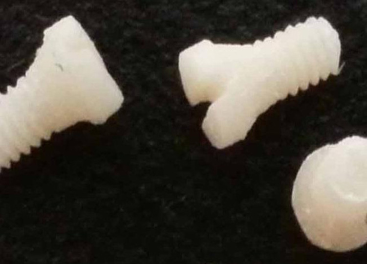 強度があって体内で溶ける。注目の医療用素材は「シルク」