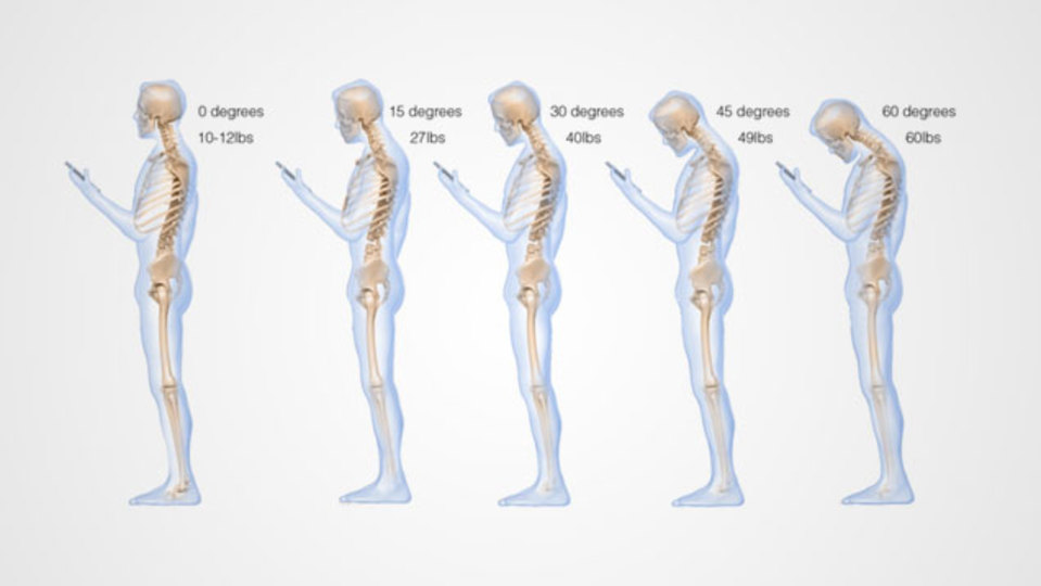 うつむいてのスマホ操作で背骨には30キロ近い負担がある:研究結果