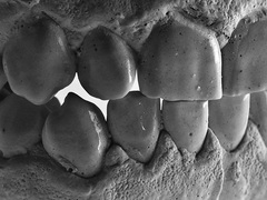 マウスガードだけではない！ 睡眠時の歯ぎしり対策法6