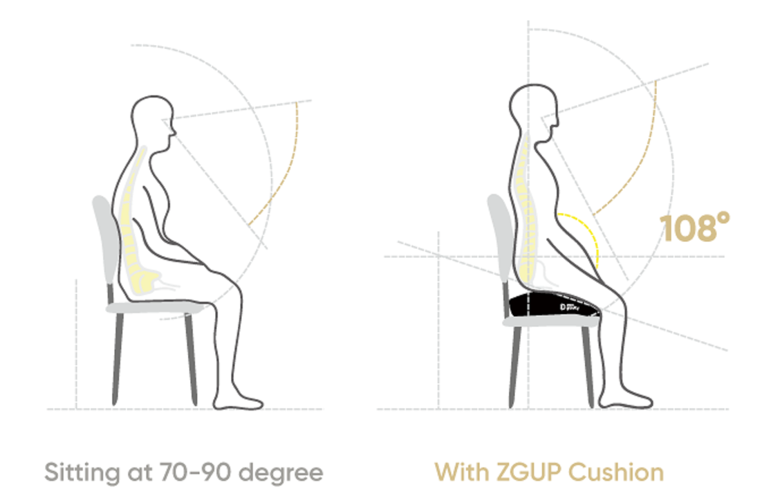 ZGUP-2