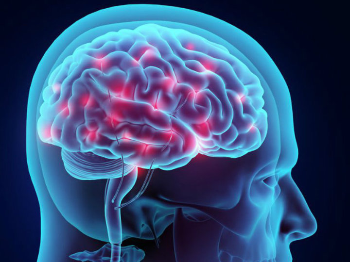 お腹の余分な脂肪は、認知症・アルツハイマーのリスクに:研究結果