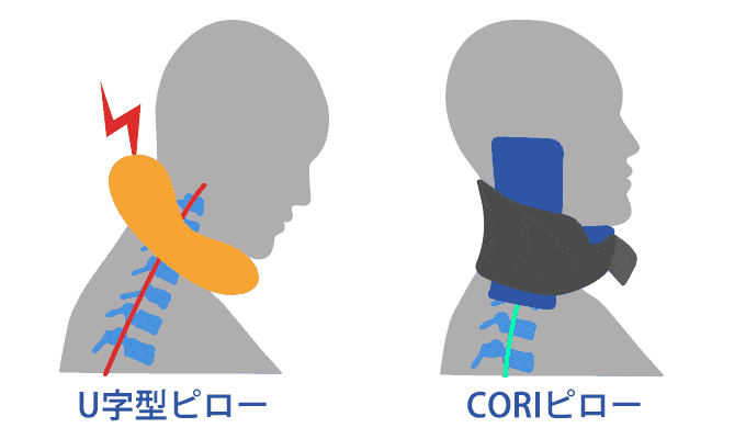 20180225-cori02