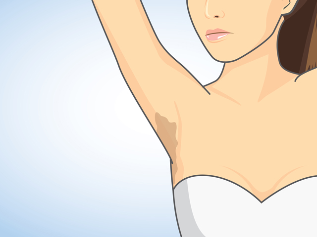 深刻な病気を発症しそう ロシア語ニュースを学ぶ