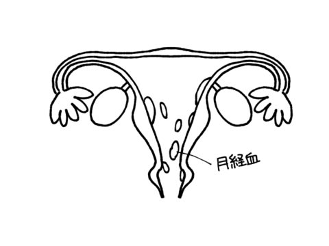 生理の仕組み なぜ出血するの Mylohas