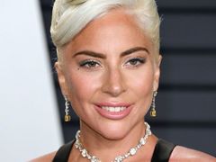 レディー・ガガのすっぴんを支える、ビタミンCに秘められたパワー