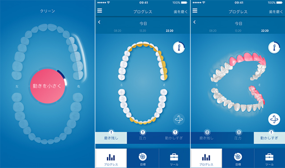 sonicare_16