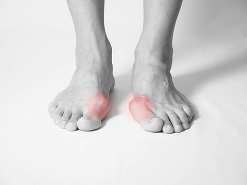 歩くたびに痛い タコやウオノメの原因は靴ではなかった Mylohas