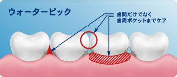 図3_re