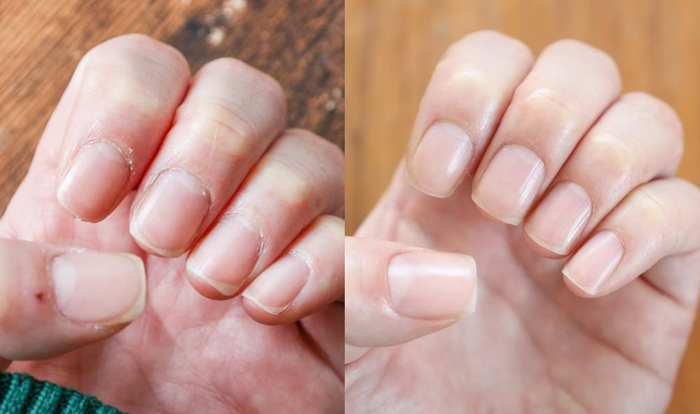 ネイルオイル 爪にコンプレックスがあった私。約1ヶ月間、HEATHの「ネイルオイル」で