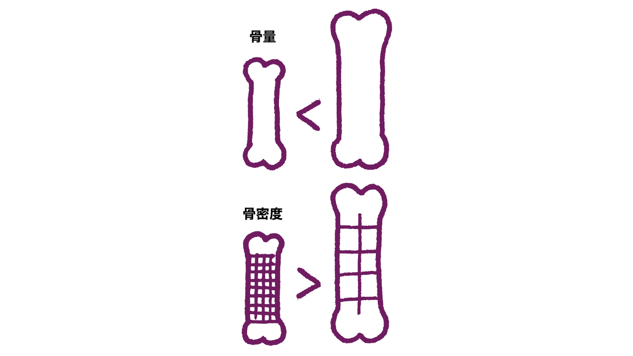 >骨量と同時に骨の質も大事にしたい