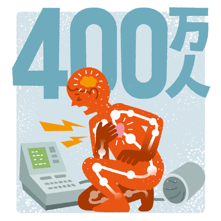 高血圧の患者の10%にあたる400万人は、ホルモンの異常が関わる可能性がある。