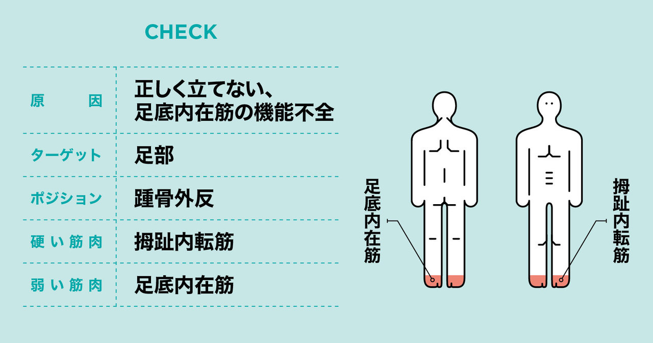 踵骨外反・扁平足の原因