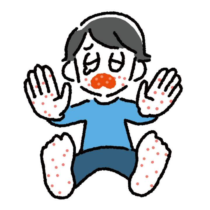 手足口病