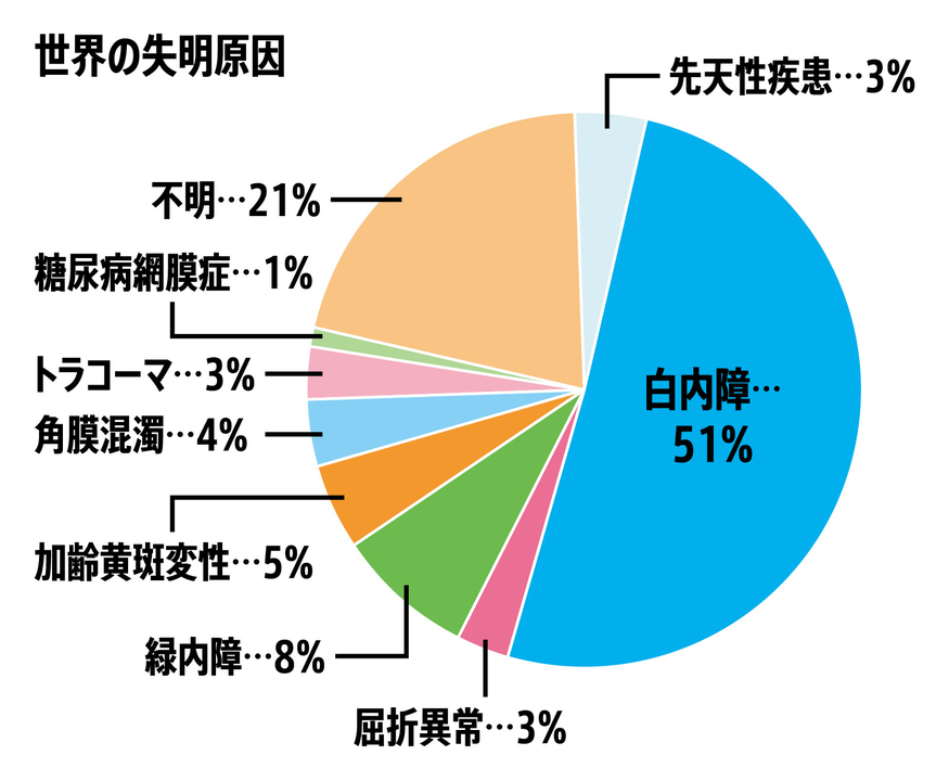 医療体制が不備な地域では手術できず失明してしまう。