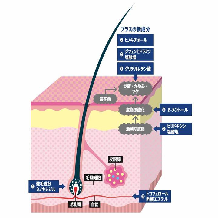 7成分配合で発毛・育毛対策
