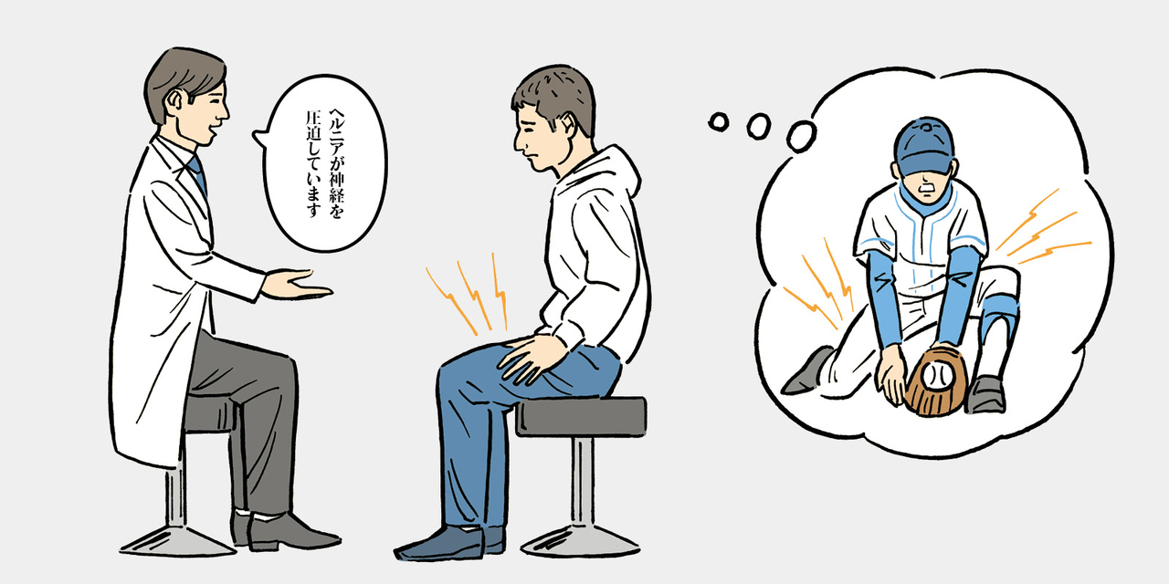 最前線医療による診察を簡易シミュレーション|椎間板ヘルニアになった場合