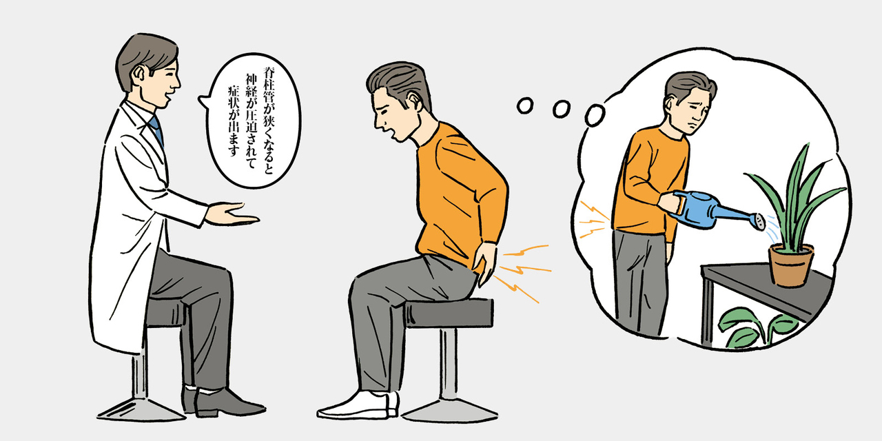 脊柱管狭窄症 の 診察