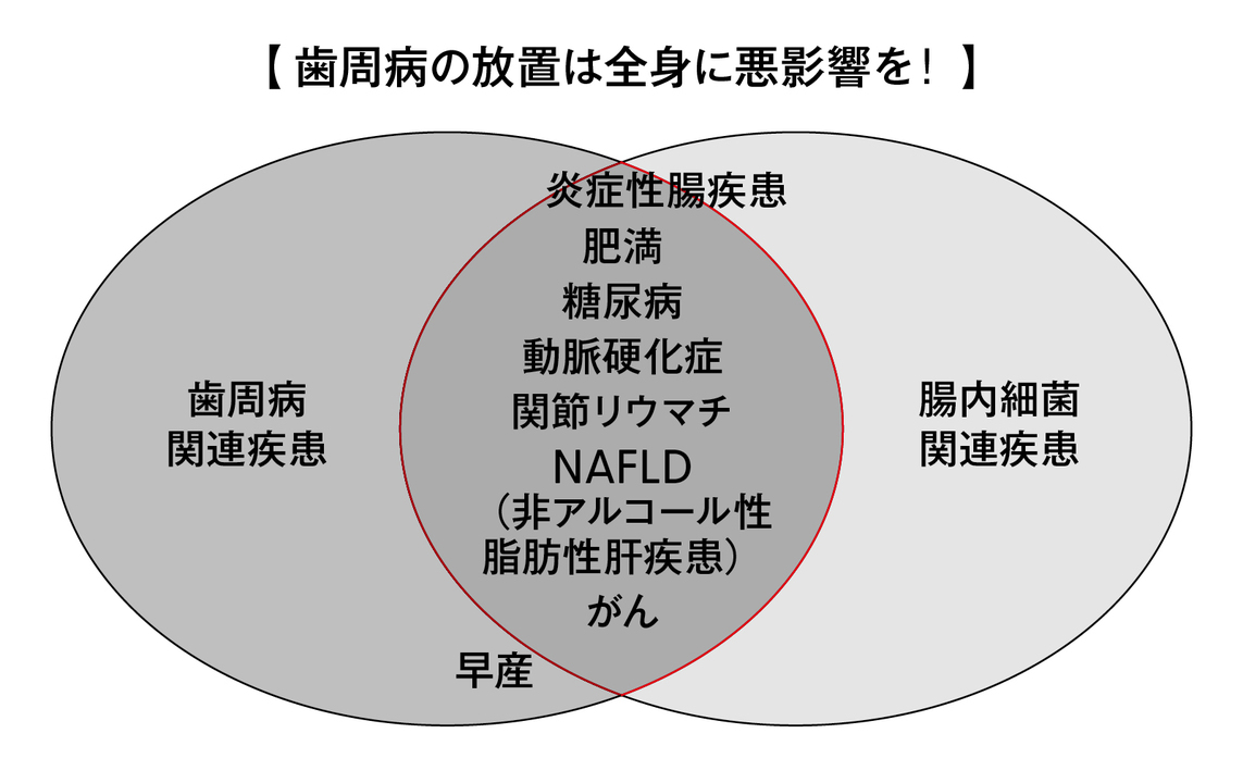 歯周病の放置は全身に悪影響を!