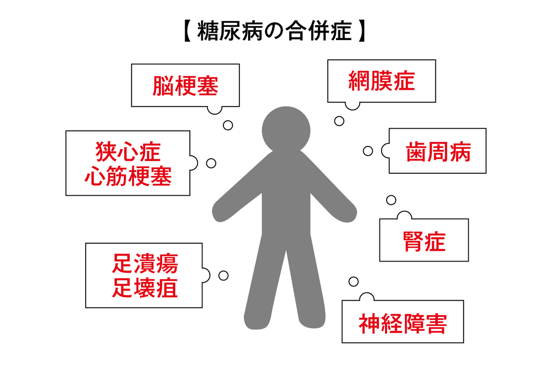 糖尿病の合併症